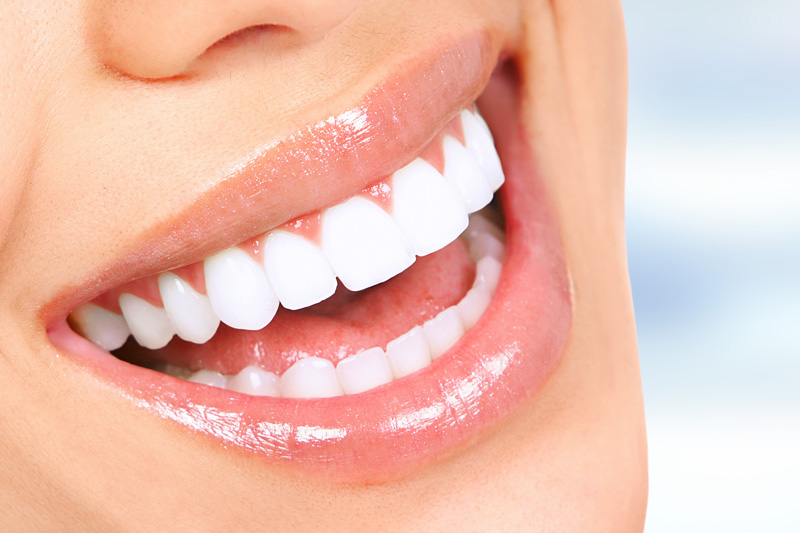 Cosmetic Dentistry in Poway