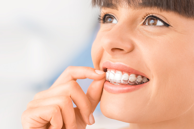 Invisalign in Poway